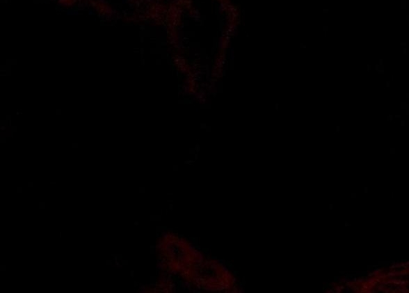 粉象生活怎么更改邀请人