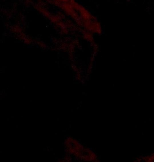 粉象生活自己开店怎么做