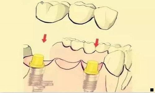 二粉象生活会员